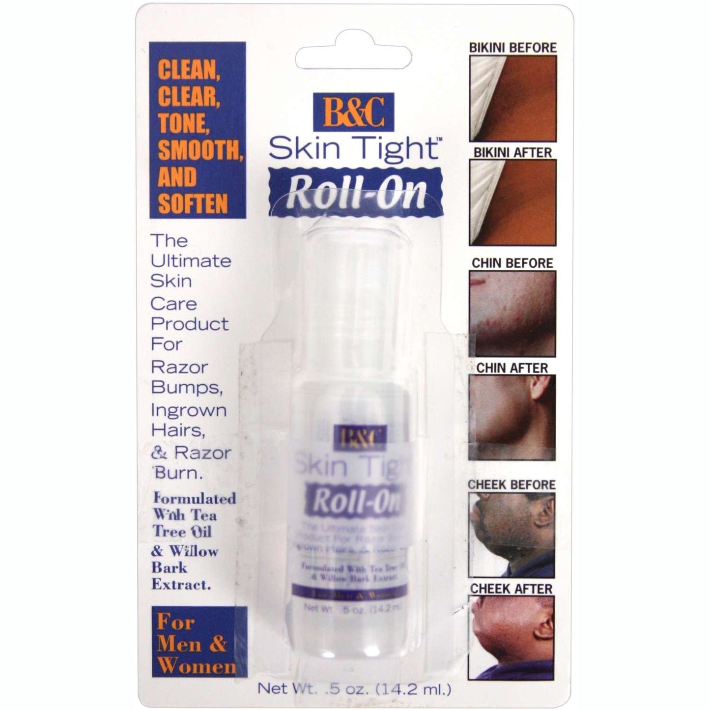 Ungüento extra para golpes de afeitado apretado para el cuidado de la piel