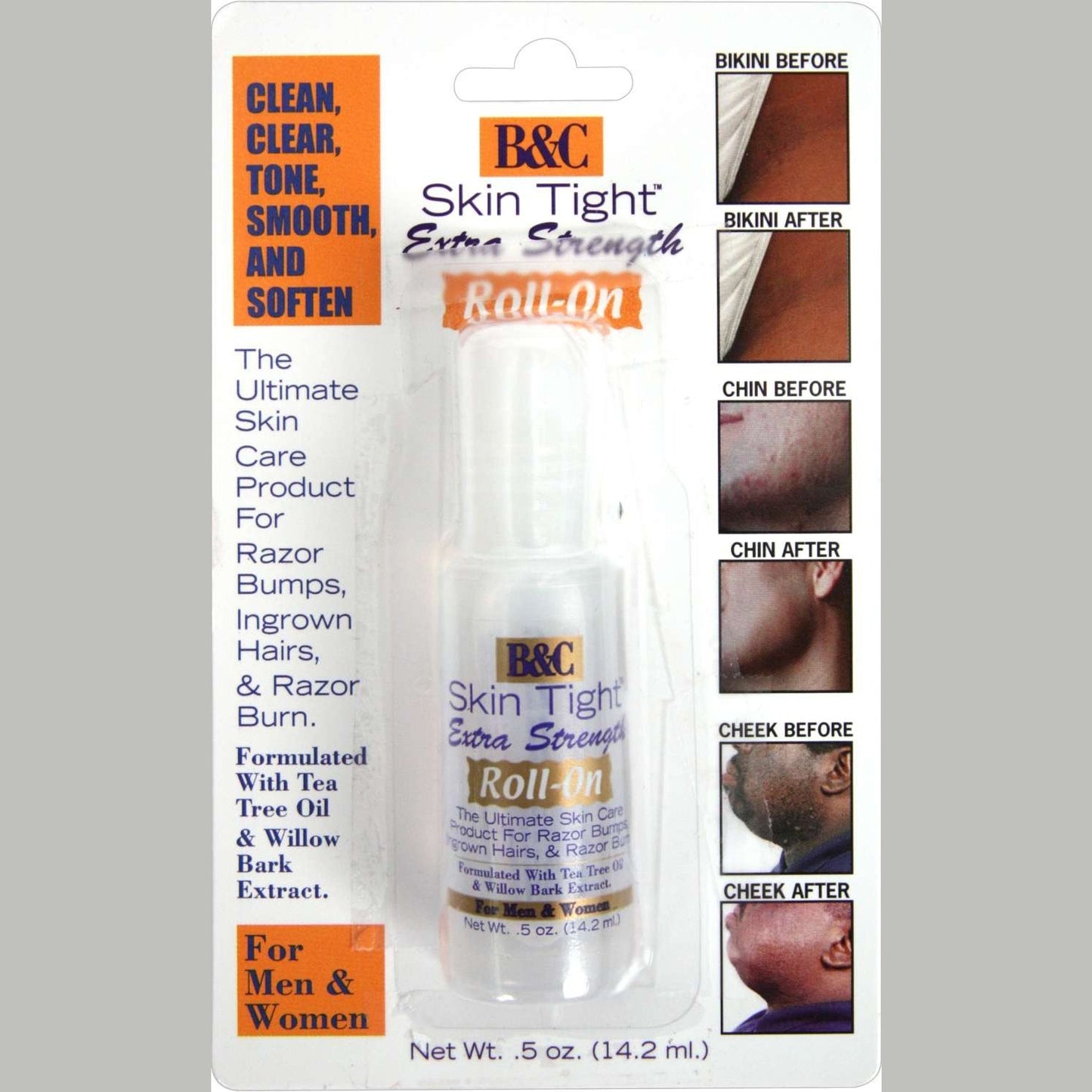 Skin Care Tight Ingrown Hair And Razor Bump Creme Extra